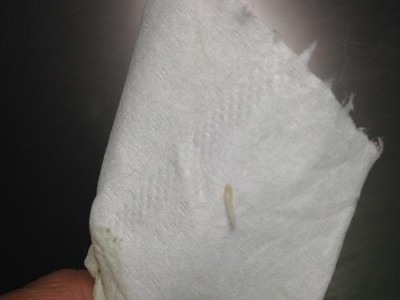 猫肚里有虫（宠物猫常见的内寄生虫症状及预防措施）