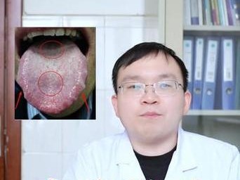 冠状病毒