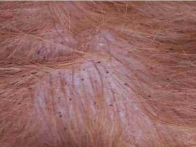 了解狗狗脂溢性皮炎的原因和治疗方法（揭秘导致狗狗脂溢性皮炎的隐患及解决之道）