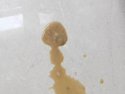 探究夏天狗吐的原因（了解狗吐的多种原因及应对方法）