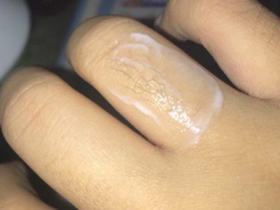 为什么小便处有阴毛？（揭秘阴毛在小便处的作用及进化原因）