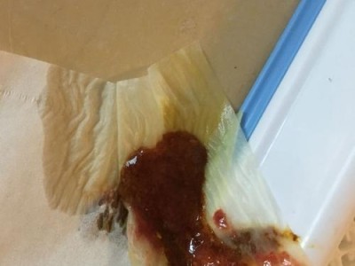 牛拉血便的原因与治疗方法（探究牛拉血便的成因和治疗方法）