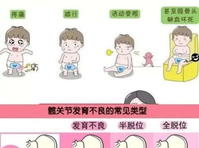 髋关节发育不良的病因及预防措施（探究髋关节发育不良的成因和预防方法，促进儿童髋关节健康发育）