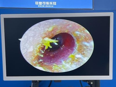 洗耳朵的正确方法与工具选择（选择正确的工具保护耳朵健康）