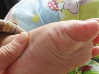 口部肿胀呕吐可能的病因及治疗方法（了解引起口部肿胀呕吐的常见疾病以及相应的治疗方法）