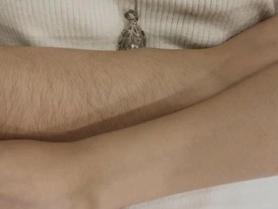以白塞病为主的脱毛现象（揭秘白塞病导致的脱毛原因及治疗方法）