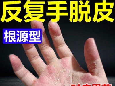 选择合适的膏药应对真菌感染（真菌感染治疗的关键——正确选择膏药）
