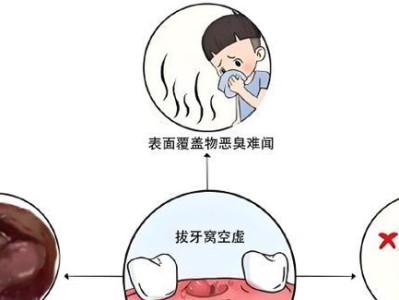 狗拔牙后的注意事项（保护口腔健康，提升生活质量）