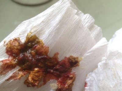 狗狗小便出血的治疗方法（用药治疗狗狗小便出血的有效选择）