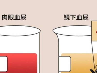 揭秘尿液颜色的奥秘（从黄到红，解读尿液背后的健康信号）