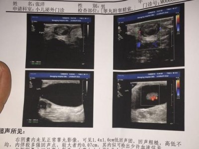 泰迪狗的疝气肉球（了解泰迪狗疝气肉球的危害，保护你的毛茸宝贝健康）