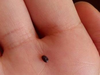 如何判断狗狗驱虫后的大便是否正常？（了解狗狗驱虫后大便的特征，保障宠物健康）