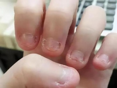 贵宾犬为什么会咬手？（探究贵宾犬咬手行为的原因及解决方法）