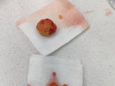 狗狗结石的症状及预防措施（了解狗狗结石的症状，保护你的宠物健康）