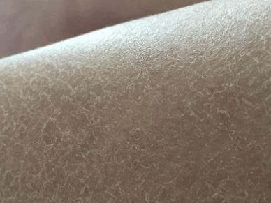 仓鼠失序症（仓鼠失序症的发病时间及影响因素）