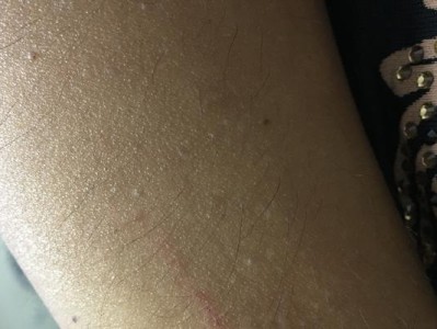 狗咬好了伤口——宠物狗的治疗能力（发现宠物狗治愈伤口的惊人效果！）