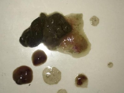 博美拉肚子药（有效、安全的肠胃调理药物）